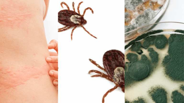Histamine, Lyme, and Mold webinar